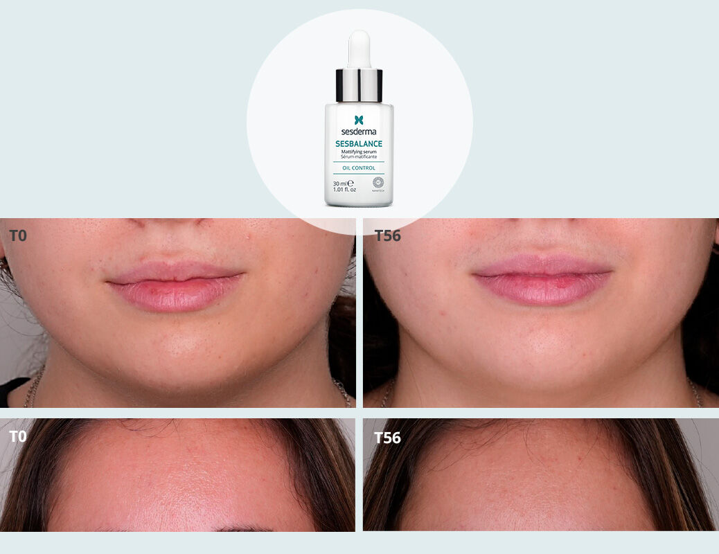 Imagen mujer eficacia antes/después sérum Sesbalance