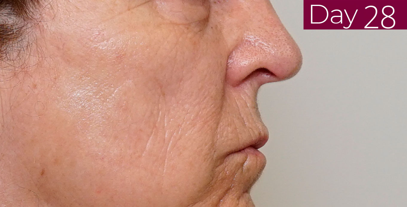 Imagen eficacia probada/después crema Ferulac