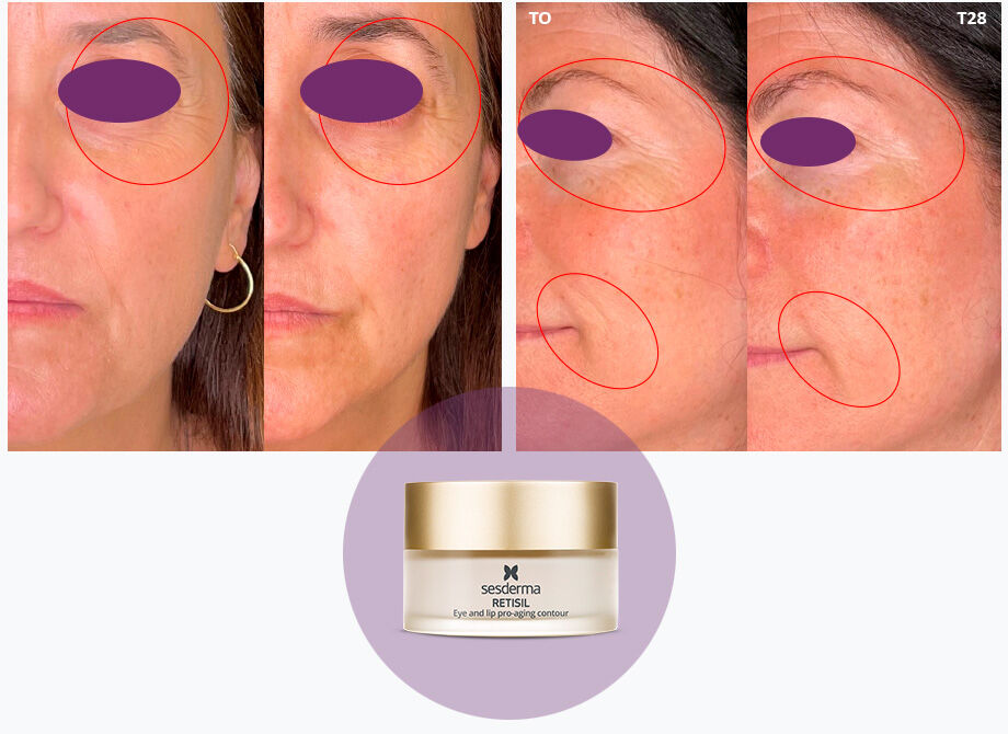 Imagen mujer eficacia antes/después crema contorno ojos Retisil