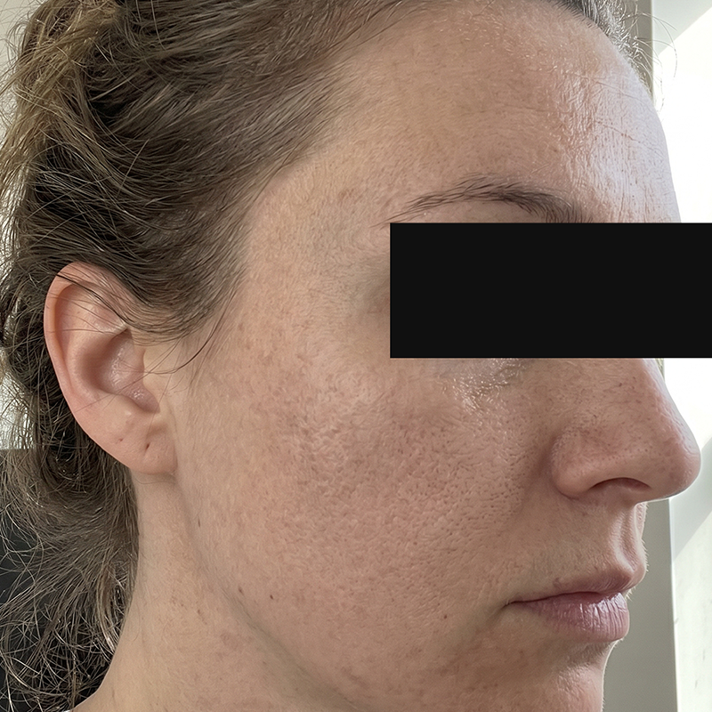 Before image