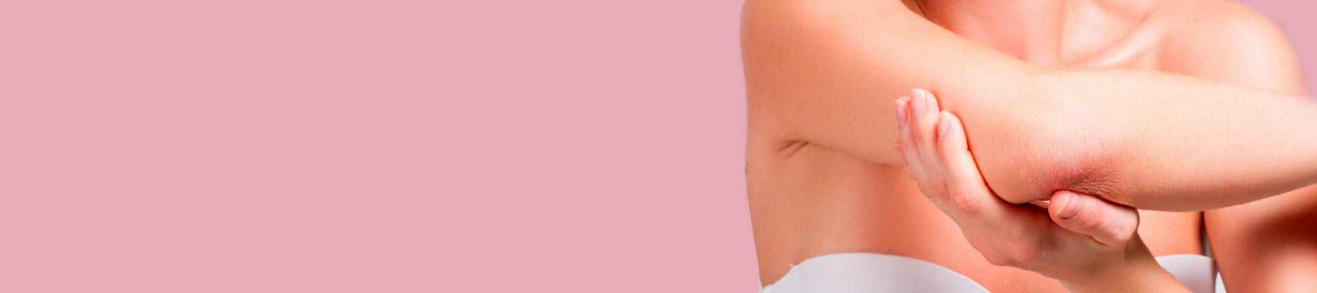 Psoriasis